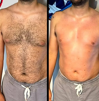 Original Hair Removal Spray Premium Quality