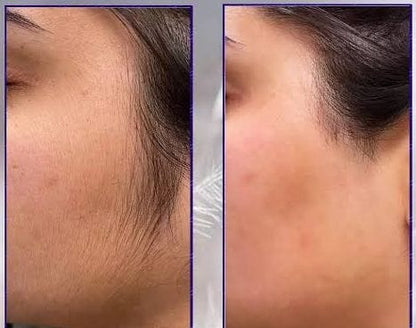 Original Hair Removal Spray Premium Quality