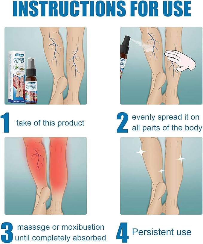 Varicose Veins Treatment