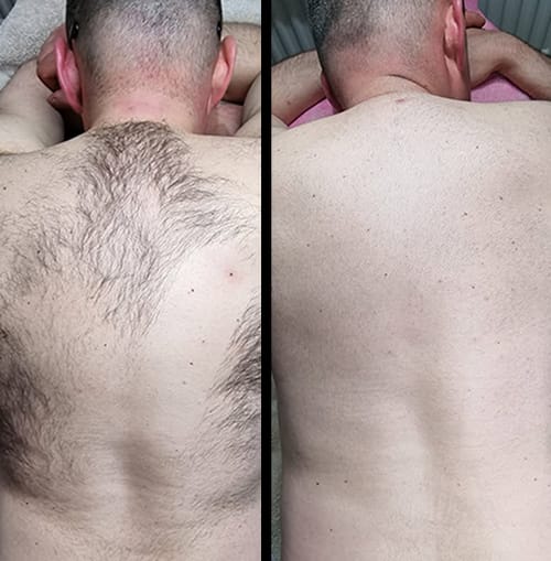 Original Hair Removal Spray Premium Quality