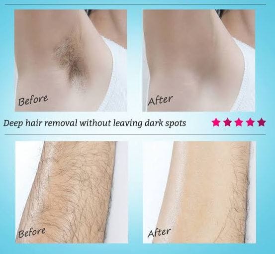 Original Hair Removal Spray Premium Quality