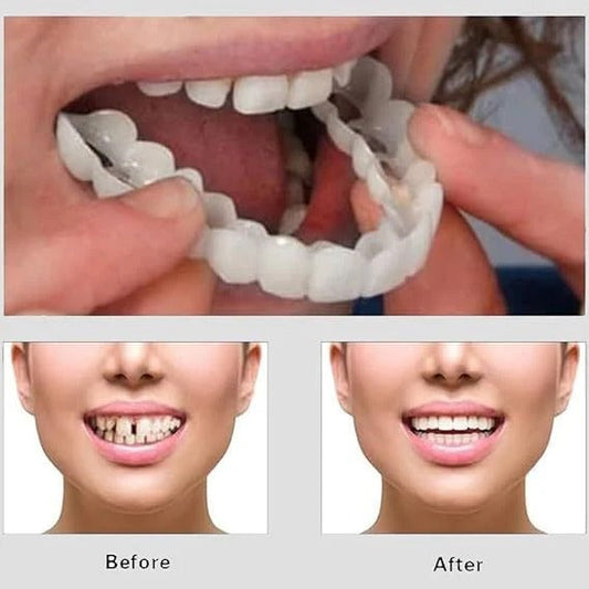Silicone Teeth Cover