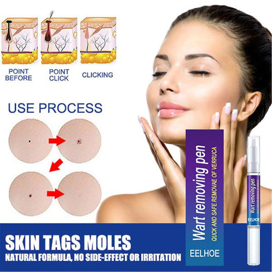 Warts & Moles Remover Pen (14 Days Money Back Guarantee)